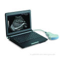 Full Digital Laptop Ultrasound Scanner Aj-6000plus